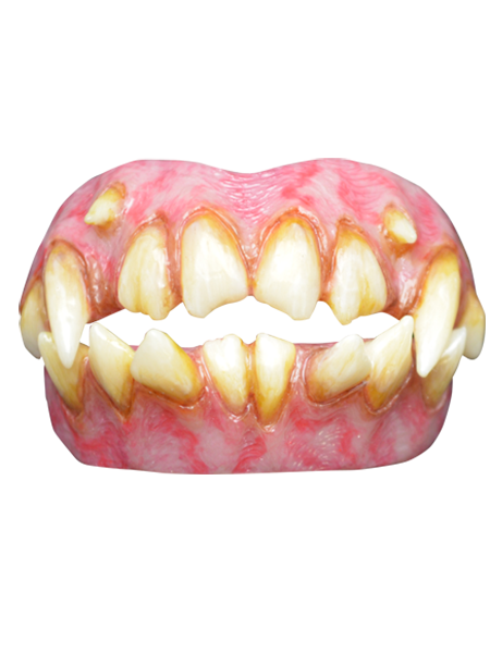ID Teeth Dentures