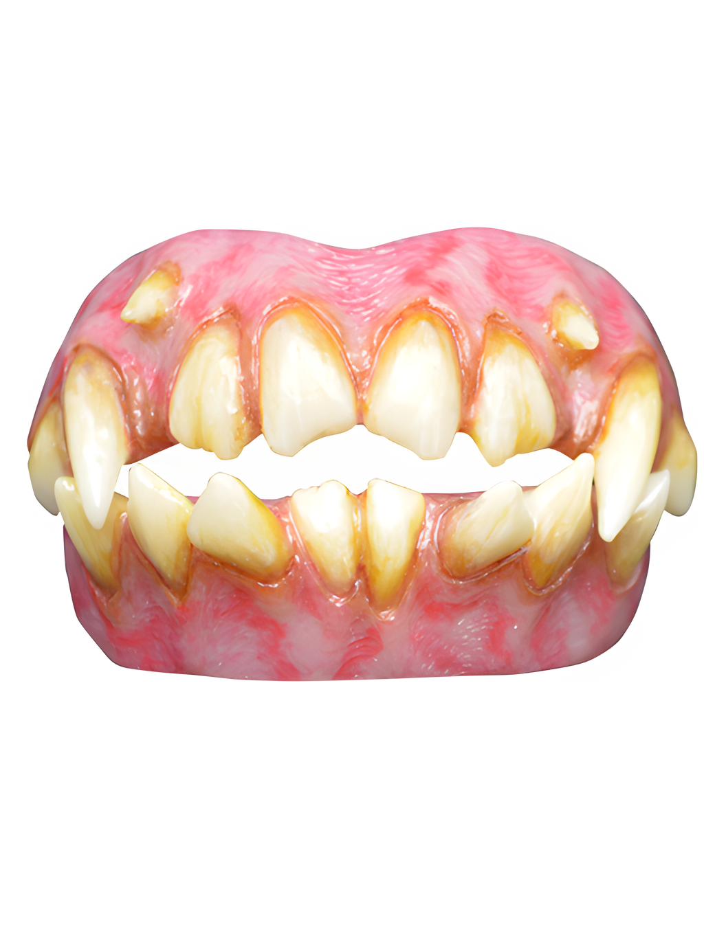 ID Teeth Dentures