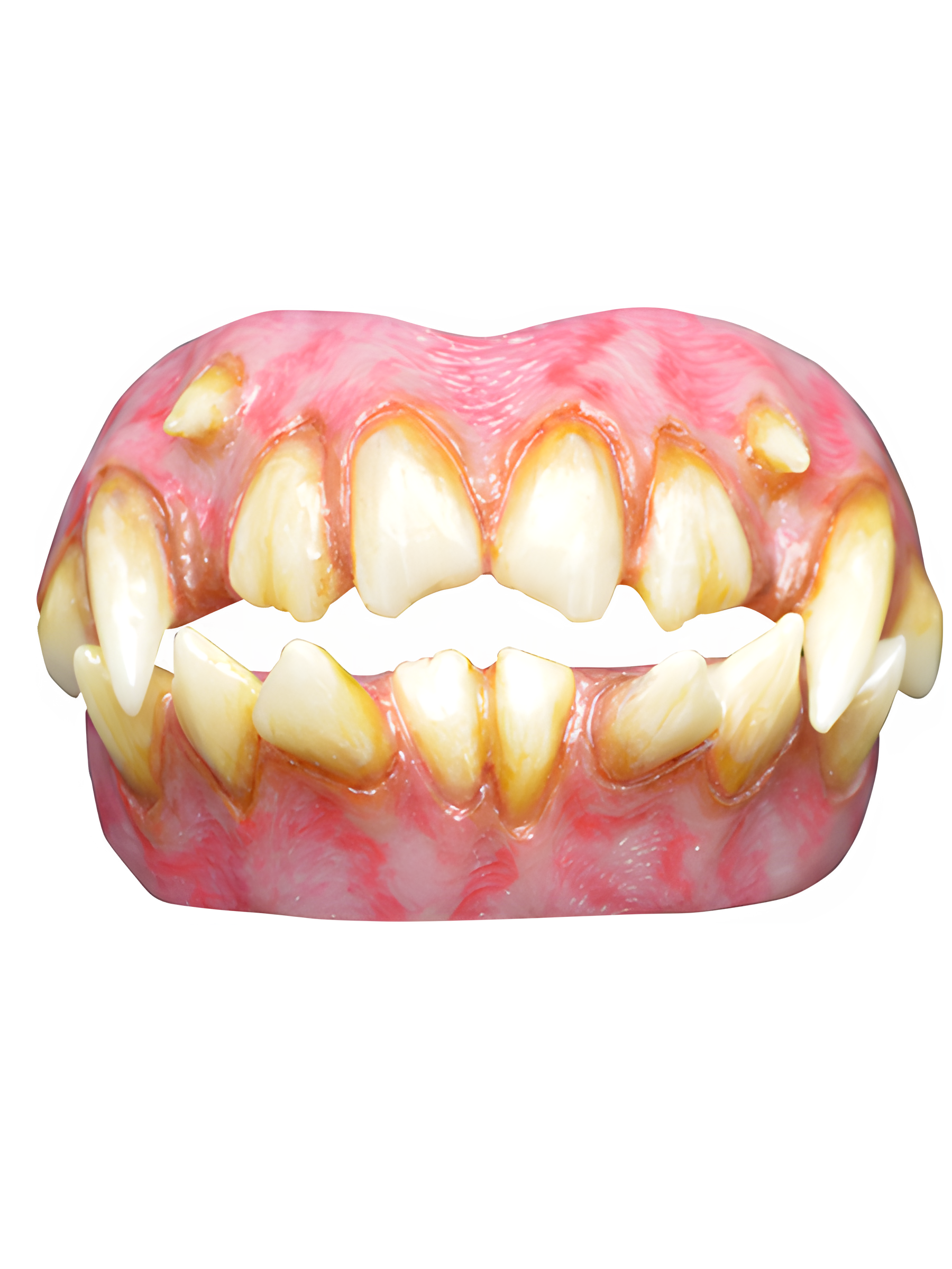 ID Teeth Dentures